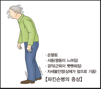 파킨슨병이란?